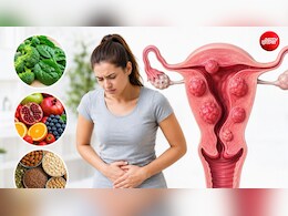 बच्चेदानी में गांठ हो तो क्या खाना चाहिए? 5 फूड्स, जिससे सूजन और दर्द से मिलेगा आराम