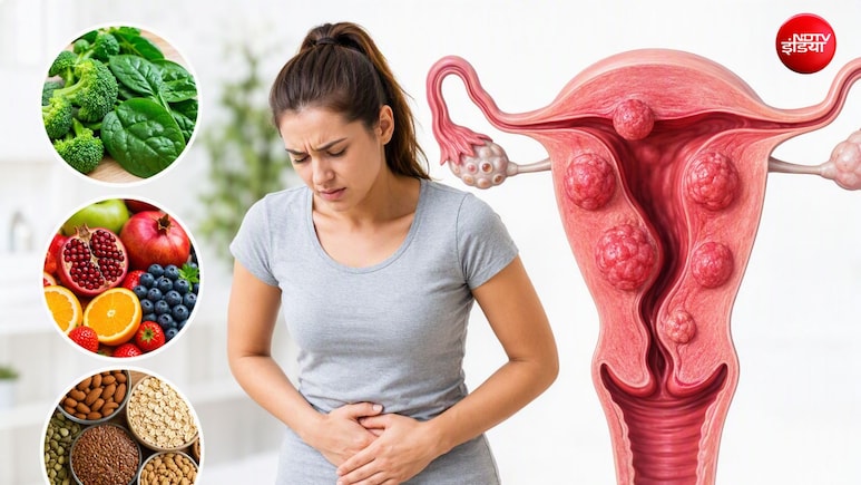 बच्चेदानी में गांठ हो तो क्या खाना चाहिए? 5 फूड्स, जिससे सूजन और दर्द से मिलेगा आराम