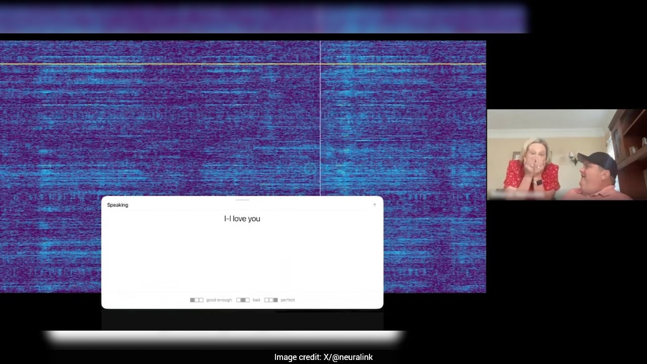 Speech-Impaired Man Uses Brain Implant To Say "I Love You", Video Viral