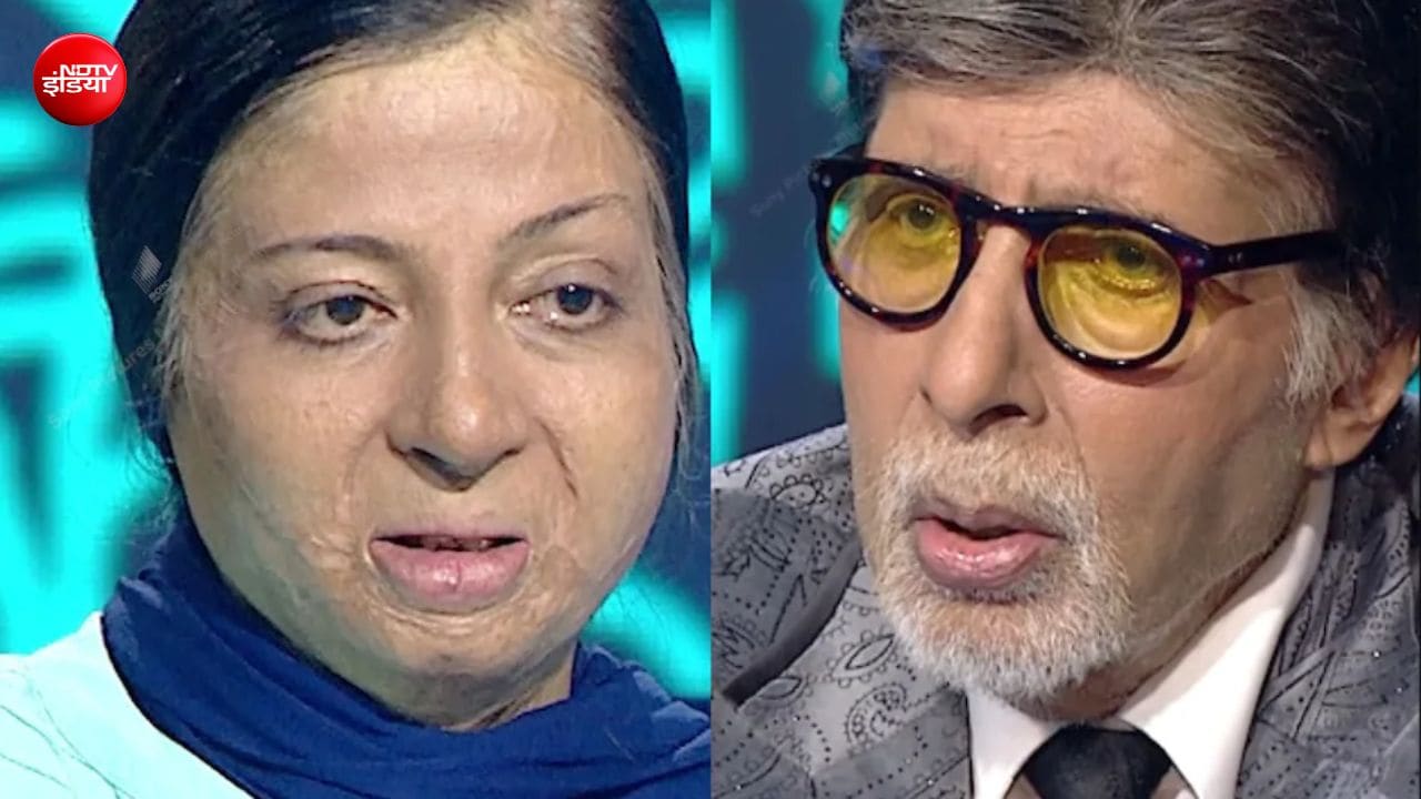 दहेज के लिए सास ने मिट्टी का तेल डालकर लगाई आग, बेटी से किया दूर, KBC में इस कंटेस्टेंट की कहानी सुन इमोशनल हुए अमिताभ बच्चन