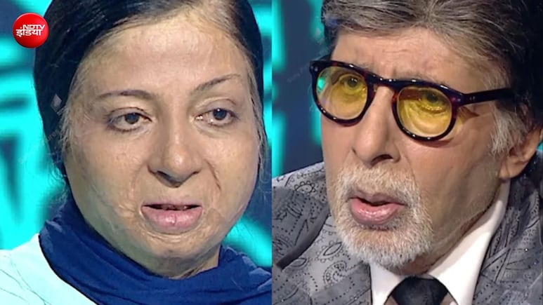 दहेज के लिए सास ने मिट्टी का तेल डालकर लगाई आग, बेटी से किया दूर, KBC में इस कंटेस्टेंट की कहानी सुन इमोशनल हुए अमिताभ बच्चन