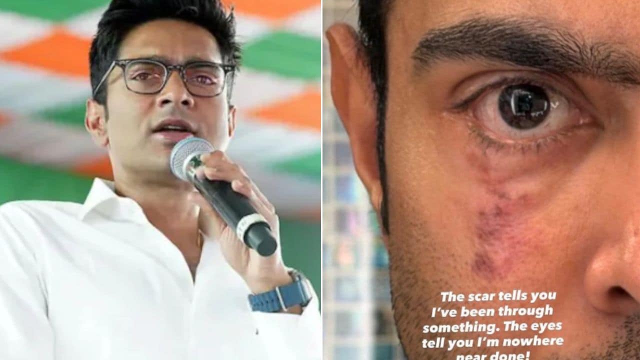 "Scar Tells You I've Been Through Something": Abhishek Banerjee's Big Message
