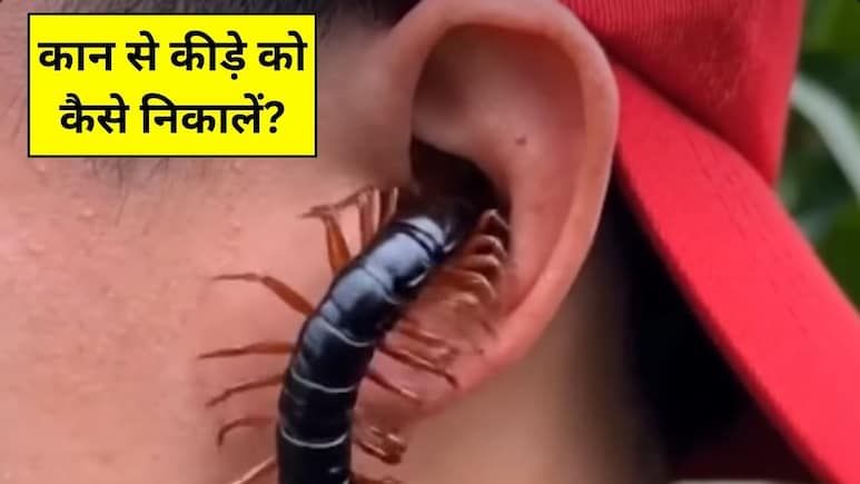 कान में कोई कीड़ा चला जाए तो कैसे निकालें? ENT स्पेशलिस्ट ने बताया सबसे पहले क्या करना चाहिए