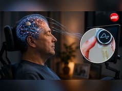 ALS में चली जाती है आवाज, लेकिन नहीं रुकती सोच, क्या Brain-to-Voice Technology बदल देगी मरीजों की जिंदगी?