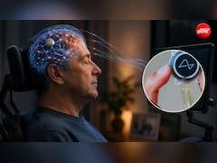 ALS में चली जाती है आवाज, लेकिन नहीं रुकती सोच, क्या Brain-to-Voice Technology बदल देगी मरीजों की जिंदगी?