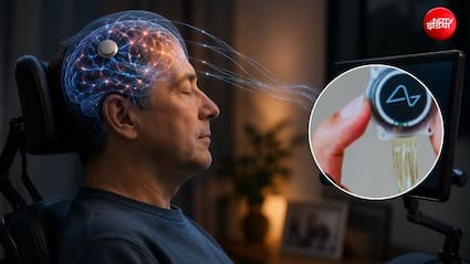 ALS में चली जाती है आवाज, लेकिन नहीं रुकती सोच, क्या Brain-to-Voice Technology बदल देगी मरीजों की जिंदगी?