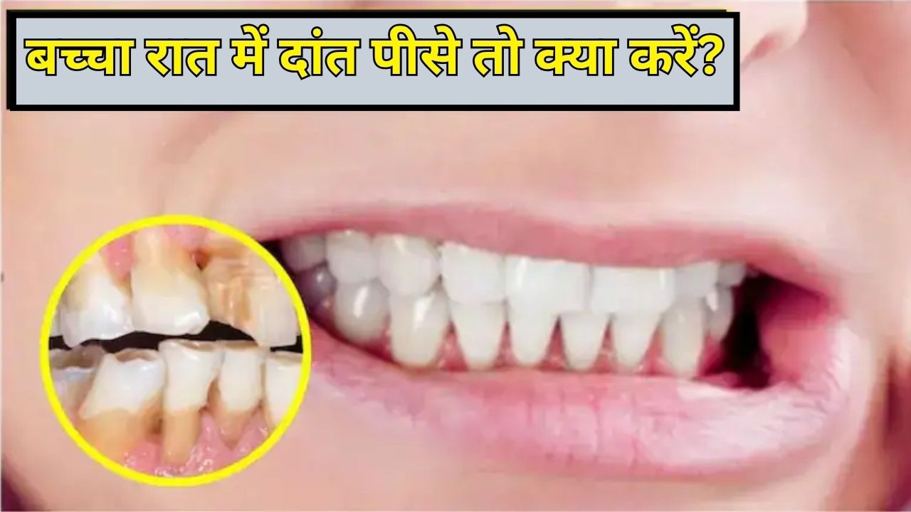बच्चा रात में दांत किटकिटाता है तो क्या करें? एक्सपर्ट से जानें बच्चे के दांत पीसने की आदत को कैसे छुड़ाएं