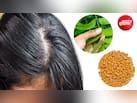 सिर में हो रही है खुजली और बाल चिपचिपे? अपनाएं ये 3 दादी के देसी नुस्खे, डैंड्रफ से भी मिलेगा छुटकारा