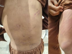 Boy, 9, Thrashed By Teacher At Jammu Madrasa, Rescued 30 Km Away