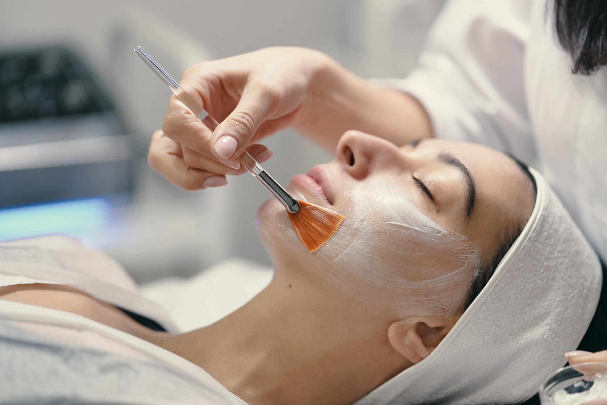 Breakouts after a facial from exposure to harsh chemicals needs skin protection