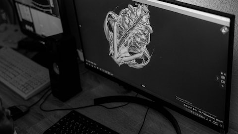 Story image