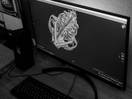 Can You Have Heart Disease With A Clear Angiogram? Doctor Explains The Hidden Causes In Women