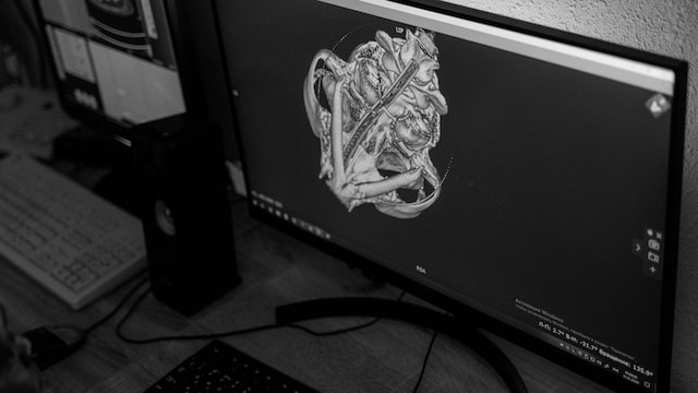 Heart disease with a clear angiogram can effect certain women