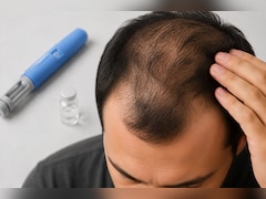वजन घटाने की दवाएं बढ़ा सकती हैं बाल झड़ने का खतरा? नई स्टडी में पुरुषों को लेकर हुआ बड़ा खुलासा