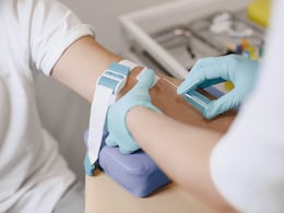Indian Researchers Develop Nanopore Sensors To Detect Parkinson's Disease At An Early Stage