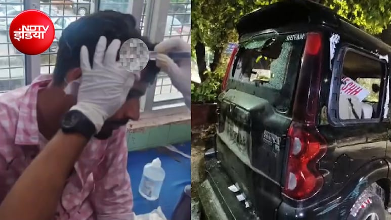 सिर फोड़ा, गाड़ी तोड़ी; DUSU चुनाव से पहले नॉर्थ कैंपस में बवाल, ABVP और NSUI ने लगाए एक-दूसरे पर आरोप