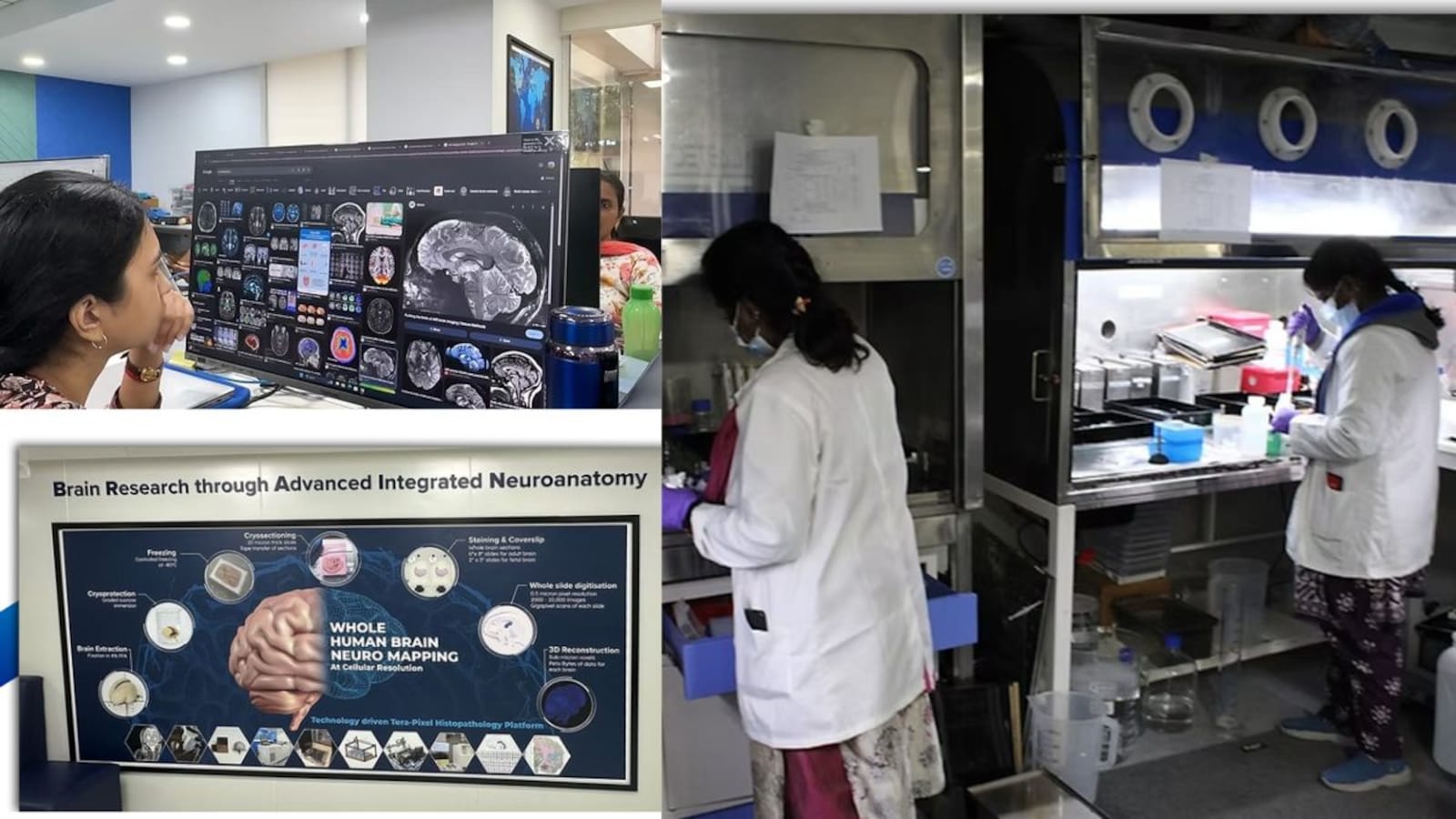 IIT Madras Maps Human Brain Through Imaging and Engineering