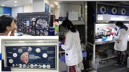 IIT Madras Maps The Human Brain By Merging Neuroscience, Engineering And Advanced Imaging