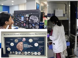 IIT Madras Maps The Human Brain By Merging Neuroscience, Engineering And Advanced Imaging