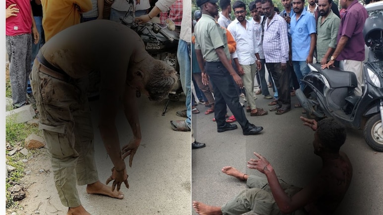 प्रपोजल ठुकराया तो खुद को आग लगाकर पीछे-पीछे दौड़ा सनकी आशिक, बोलता रहा- अब तो मान जाओ