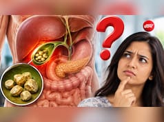 पित्त की पथरी का ऑपरेशन कब करवाना चाहिए?