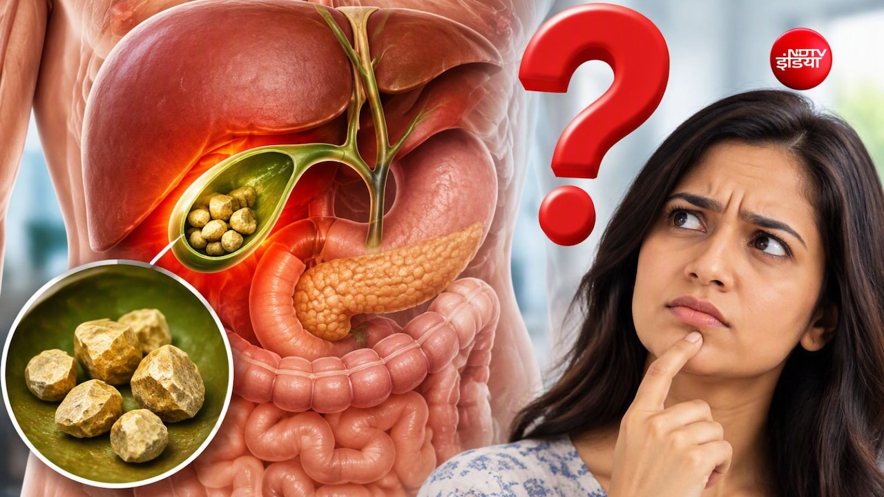 पित्त की पथरी का ऑपरेशन कब करवाना चाहिए?