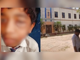 Mysuru Teacher Punches 16-Year-Old Student, Leaving Blood Clot In Eye