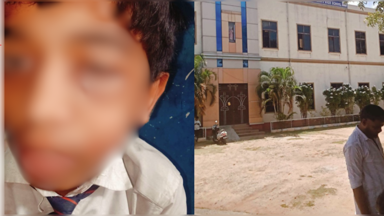 Mysuru Teacher Punches 16-Year-Old Student, Leaving Blood Clot In Eye