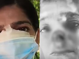 भीख देने से मना करने पर भिखारी ने गोवर्धन परिक्रमा कर रही महिला की दांत से काटी नाक