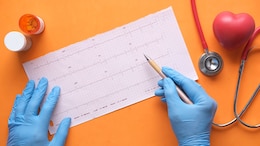 Beyond A Slow Heartbeat: Understanding Irregular Heart Rhythm And Its Impact