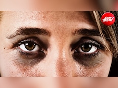 भरपूर नींद के बाद भी क्यों रहते हैं डार्क सर्कल्स? एक्सपर्ट से जानिए Dark Circles से छुटकारा पाने के लिए क्या इस्तेमाल करें