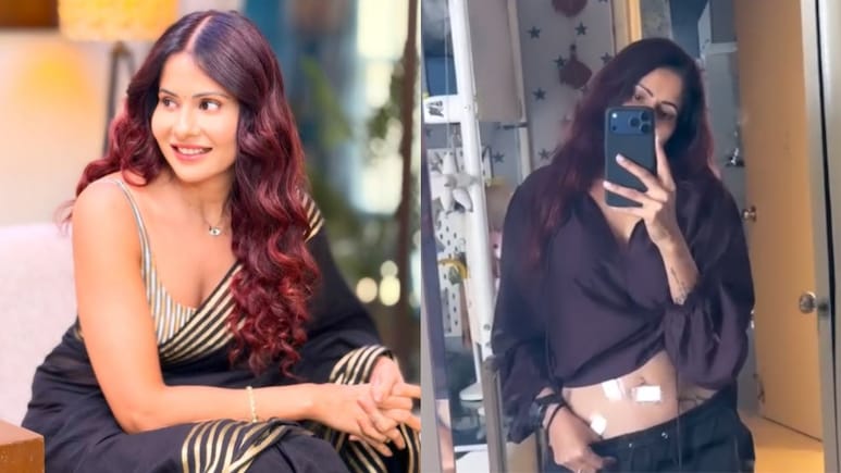 'My Stomach Is So Bloated': Chhavi Mittal Opens Up About Recovery Challenges After Fibroid Surgery