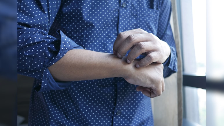 Chinese Man Starts 'Itch-Scratching' Business, Earns Rs 14 Lakh Per Month: "It's In Great Demand"