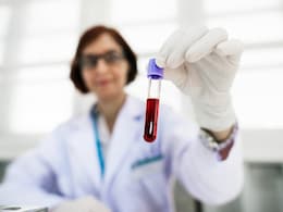 What Is Blood Cancer? Types, Symptoms, Causes And Treatment Explained