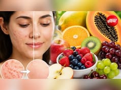 फोड़े-फुंसी हटाने के लिए कौन सा फल खाएं? 5 फ्रूट्स, जिनसे त्वचा हो सकती है साफ