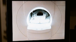 Could A New Cancer Scan Help Doctors Better Select Ovarian Cancer Patients For Surgery?