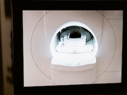 Could A New Cancer Scan Help Doctors Better Select Ovarian Cancer Patients For Surgery?