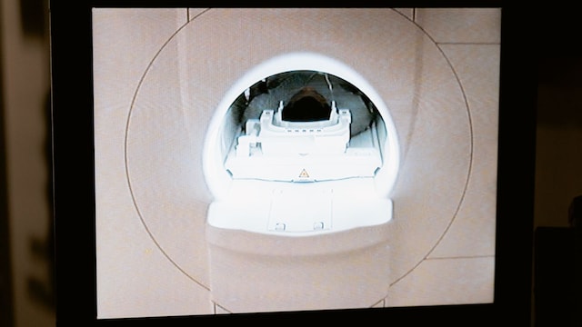 Could A New Cancer Scan Help Doctors Better Select Ovarian Cancer Patients For Surgery?