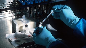 Molbio Diagnostics Stock Soars 9% As It Becomes Jefferies Top Med Tech Pick At Initiation