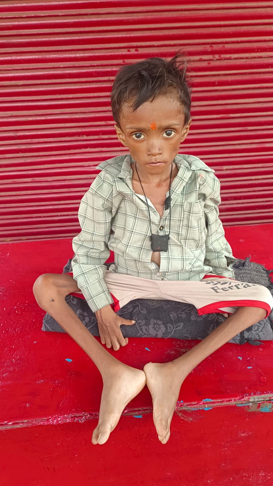 umaria sanam baiga malnutrition death umaria sanam baiga malnutrition death