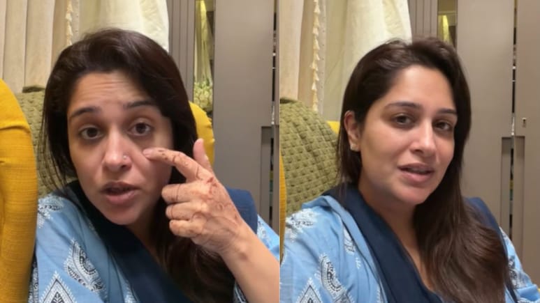 'Been Worried': Dipika Kakar Opens Up About Red Eyes Amid Cancer Recovery