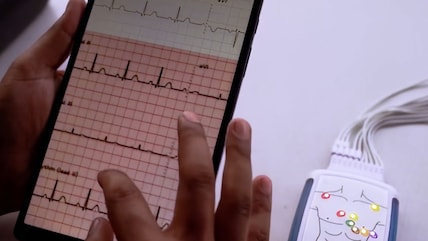 Closing India's Cardiac Care Gap, One ECG at a Time