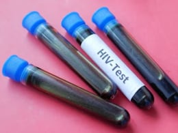 Fiji Declares National HIV Emergency As Infections Surge 16-Fold Since 2019