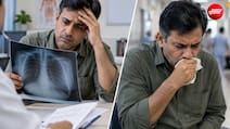 खांसी नहीं हो रही ठीक, चेस्ट X-Ray रिपोर्ट है नॉर्मल? समझें डॉक्टर कब बढ़ाते हैं दूसरे टेस्ट