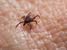 Ghaziabad Reports 3 Scrub Typhus Cases: What Is It And How Does It Spread?