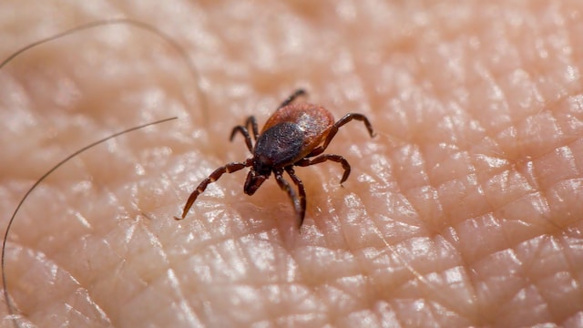Ghaziabad has reported 3 scrub typhus cases and the infection can spread easily if ignored