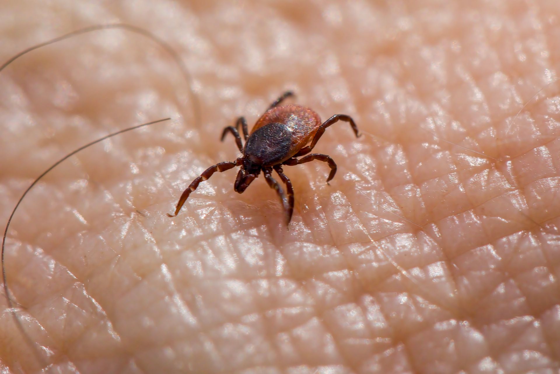 Ghaziabad has reported 3 scrub typhus cases and the infection can spread easily if ignored