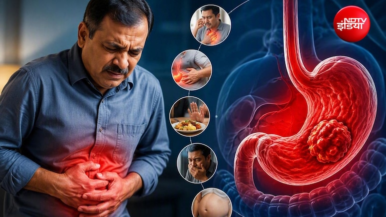 पेट के कैंसर का पहला संकेत क्या है? ये 6 लक्षण, जिन्हें गैस-अपच समझ लेते हैं ज्यादातर लोग