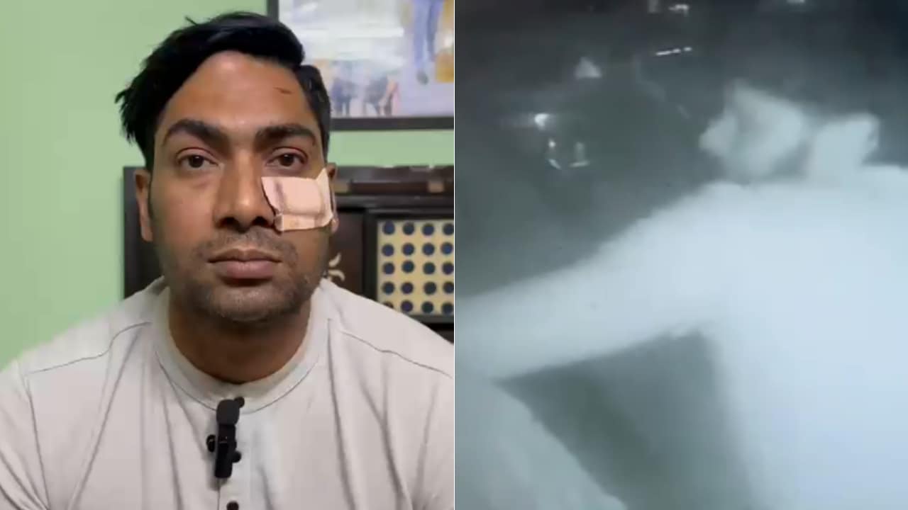 Delhi Cop Thrashed With Baseball Bat After Argument, Gets 5 Stiches Near Eye