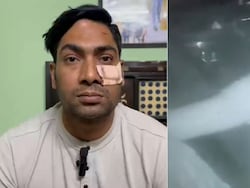 Delhi Cop Thrashed With Baseball Bat After Argument, Gets 5 Stiches Near Eye